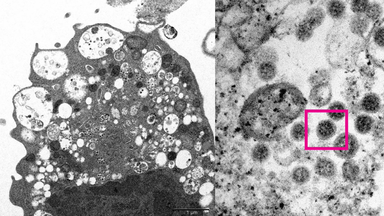 港大醫學院公布顯微鏡下Omicron變種病毒株照片