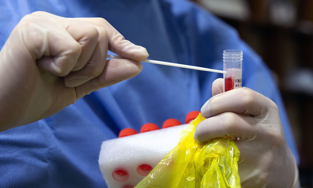 國家藥監局已批准14個新冠病毒抗原檢測試劑