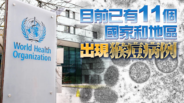 世衛組織：全球已發現80例猴痘確診病例 50例待確認