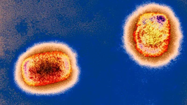 猴痘疫情蔓延 法國德國首次通報病例