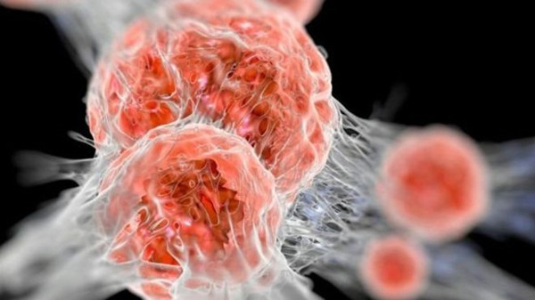 日本癌症患者10年平均存活率為58.3% 