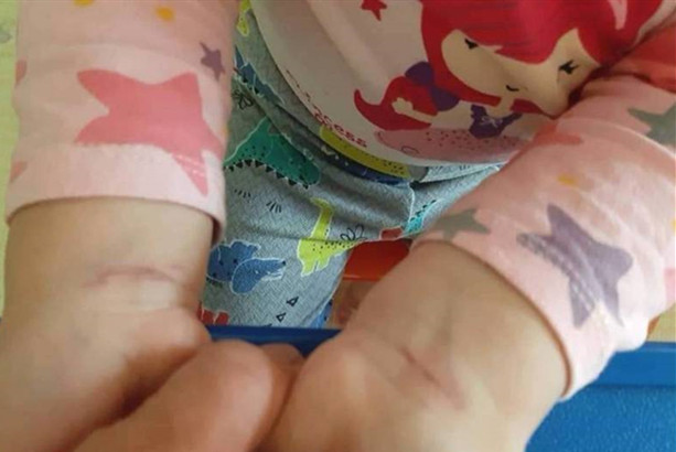 台南某幼兒園疑虐童 市府調查裁罰