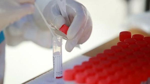 深圳報告1例境外輸入無症狀感染者 曾6次核酸呈陰性