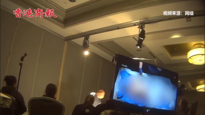 有片 | 美新冠死者捐出遺體被付費直播解剖 門票高達500美元
