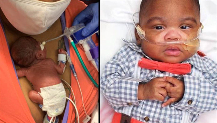 出生僅420克！美國男嬰被認證為世界上存活率最高的早產兒