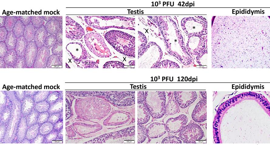 港大研究發現新冠病毒可致男患者性腺機能減退及生育能力下降