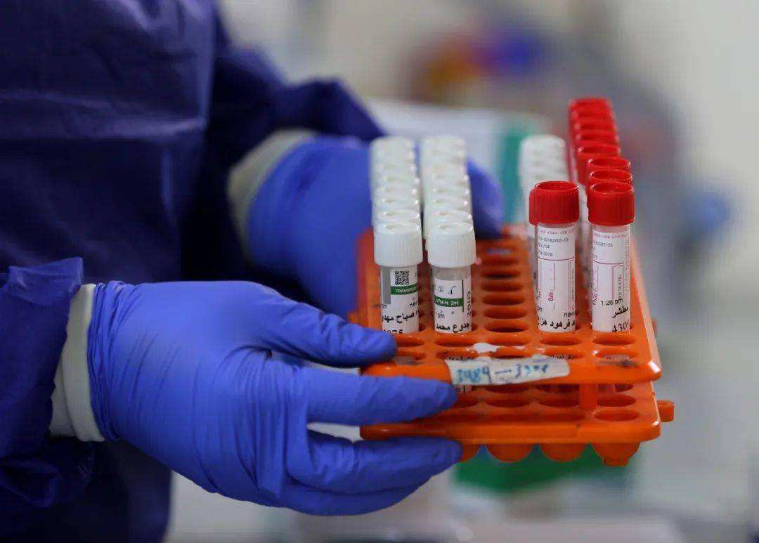 瀋陽一核酸陽性人員隱瞞旅居史被立案偵查