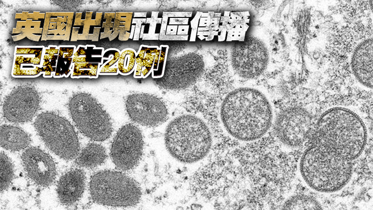 比利時要求猴痘病例進行21天自我隔離  英籲密接者隔離21天
