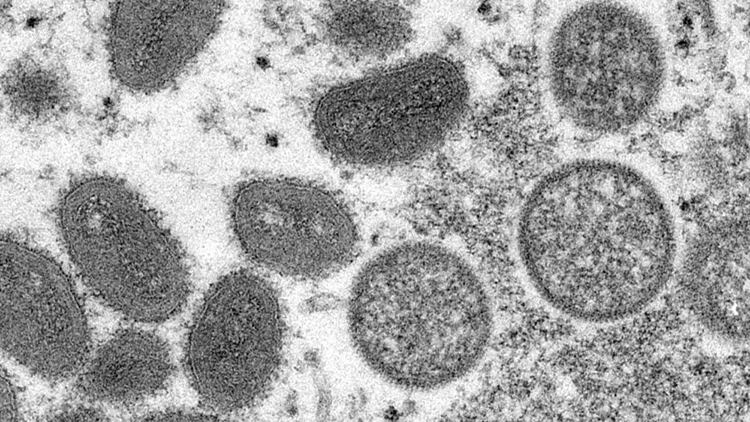 美國成世界上已知猴痘病例最多國家