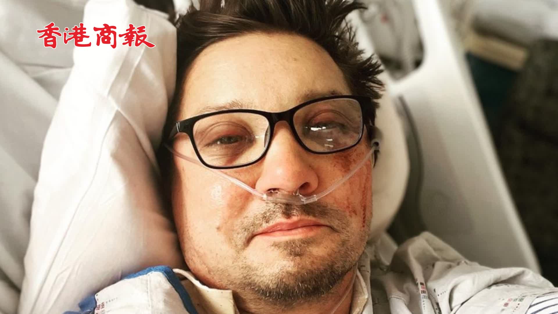 有片｜「鷹眼」扮演者維納被鏟雪車碾壓送院 術後已向網友報平安