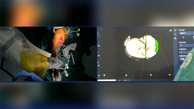 海拔4000米，來自深圳的它穩穩操作手術