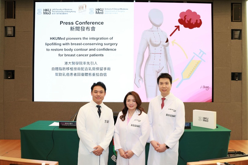 港大醫學院率先引入自體脂肪移植技術配合乳房保留手術 助乳癌患者重拾自信 